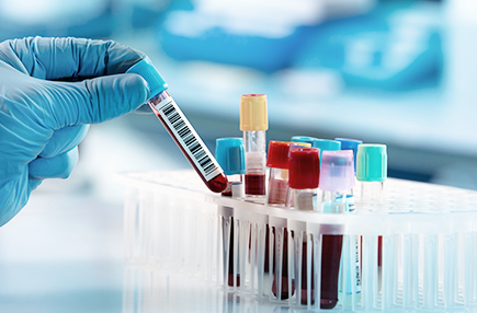 임상화학팀 이미지